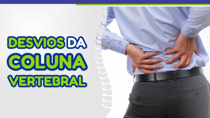 Imagem de DESVIOS DA COLUNA VERTEBRAL 